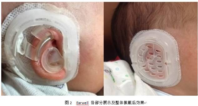 Earwell ������
