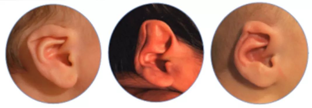 ��̬����